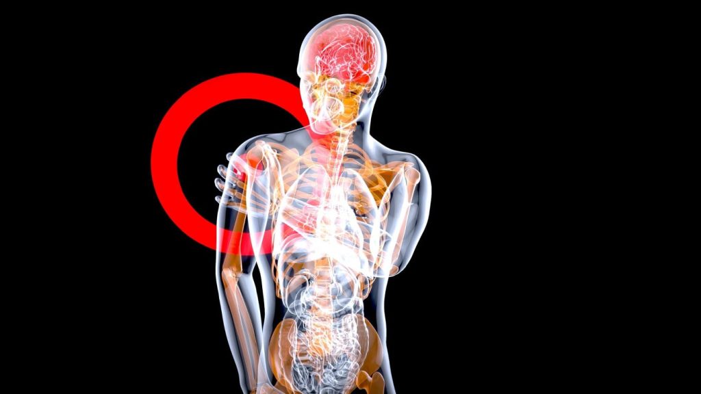 Brachial Plexus Block in Scottsdale