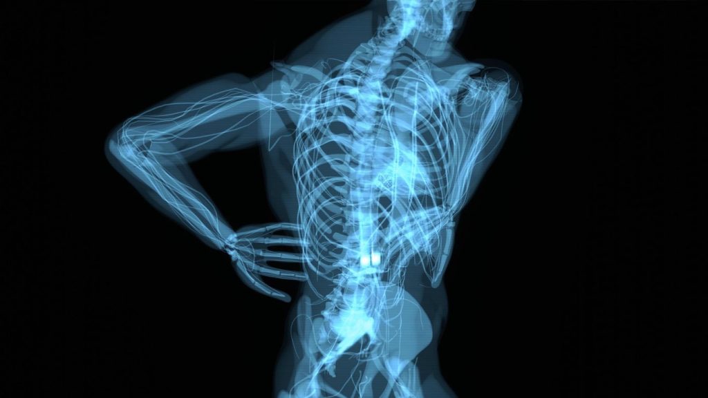 Intercostal Nerve Block in Scottsdale