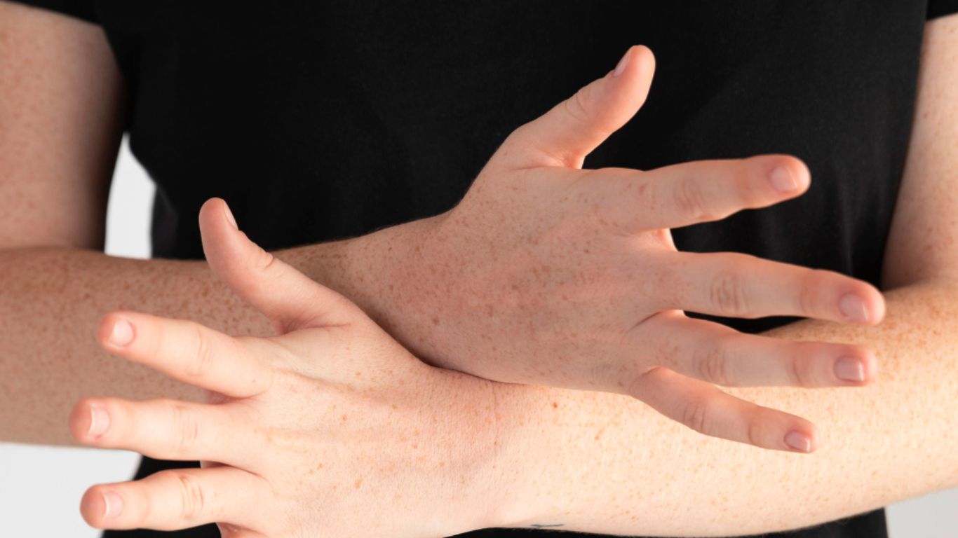 Is Arachnoiditis Permanent? What Science Actually Knows